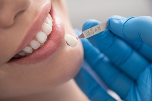 5 Reasons You May Have a Loose Dental Crown