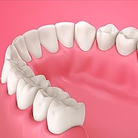 Gum Disease Kennett Square, PA